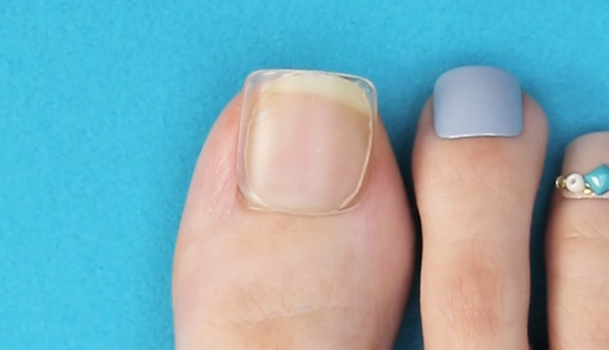 エスニックな雰囲気が爪先まで ボヘミアンフットネイル C Channel