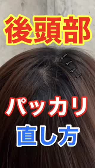 後頭部パッカリ直し方