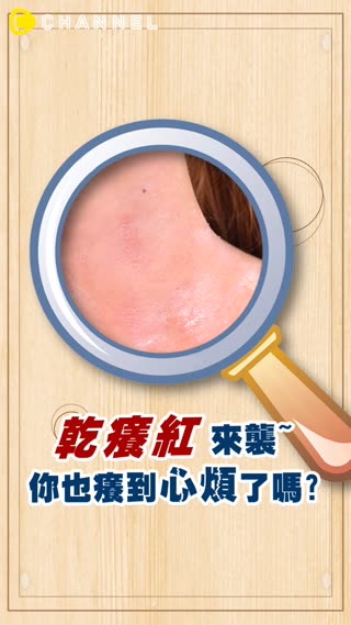 敏感肌&乾肌女孩一定要看！解決泛紅、乾癢症頭，跟著用皮膚就乖乖！