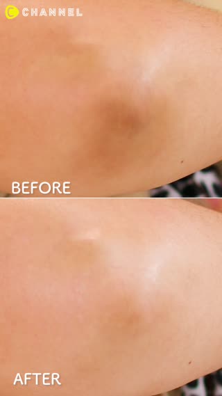 Cara Memutihkan Siku