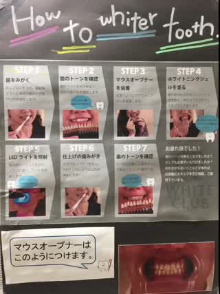 低価格でホワイトニングの方法＼(^^)／