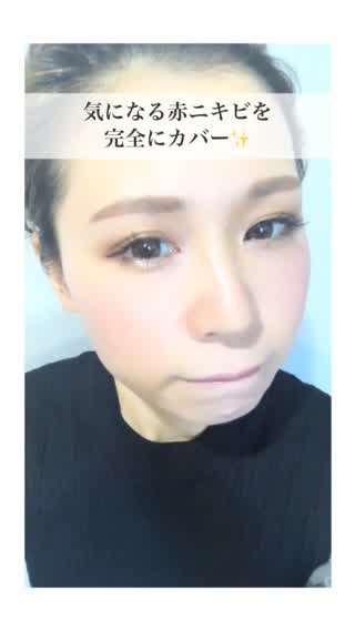 気になる赤ニキビを完全にカバー‼️