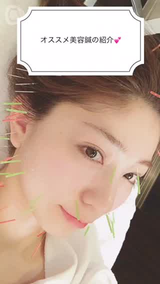 オススメ美容鍼店を紹介！施術中の様子＆ビフォーアフター٩( ᐛ )و