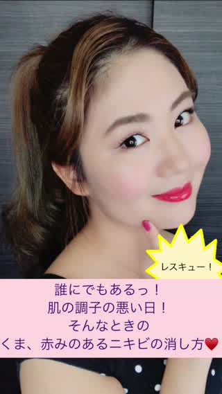 \\いつでも可愛くっ！クマや赤みのあるニキビの消し方//