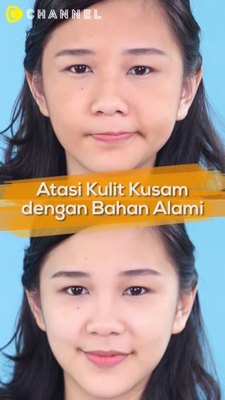 Atasi Kulit Kusam dengan bahan Alami