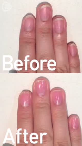 ぴかぴか☆ネイルケア(1)