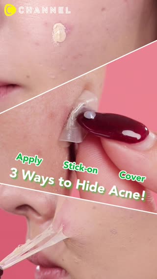 Hide Acne while Wearing Makeup 3 Ways!
