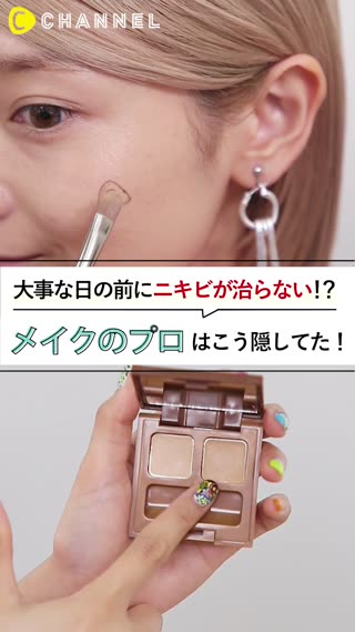 ニキビが治らなくても大丈夫！しっかり隠せるプロのワザ♡
