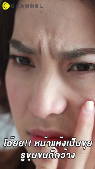 หน้าแห้งเป็นขุย ใช้โลชั่นน้ำตบ Hatomugi