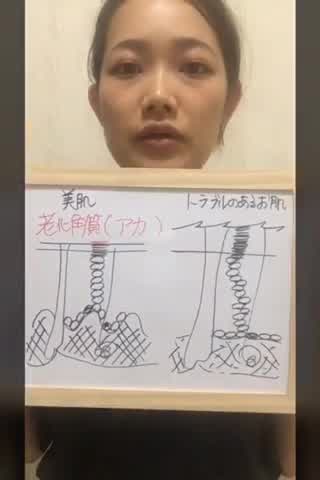 第3回 美肌への道(加齢編完結)