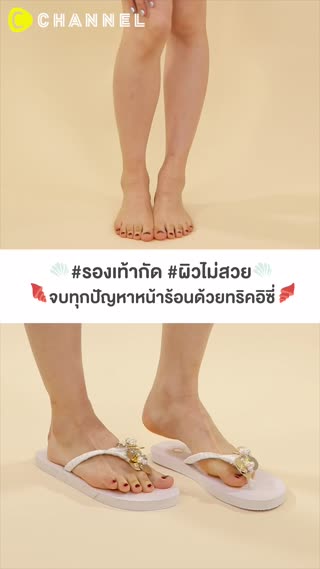 #รองเท้ากัด #ผิวไม่สวย  จบทุกปัญหา