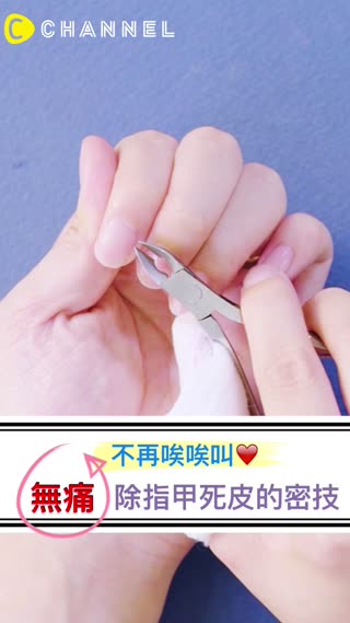 不再唉唉叫♥無痛除指甲死皮的密技